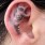 Hearing Loss Among Teenagers Has Doubled Since 1985